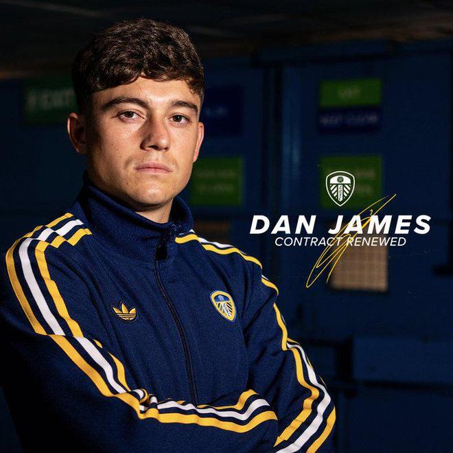 利兹联青训输出(利兹联阵型) 利兹联青训输出(利兹联阵型)